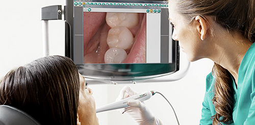 Picture of Intraoral Camera