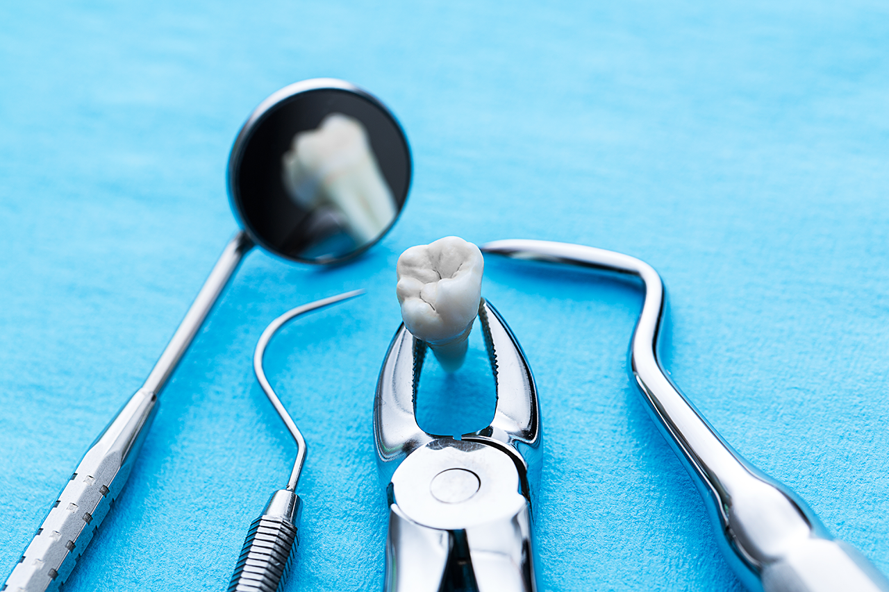 Picture of Tooth Extraction